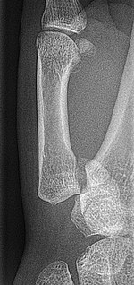 Bennett-Faktur seitlich cropped.jpg