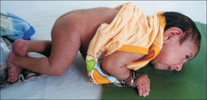 PMC2840790 IJHG-14-67-g002.png