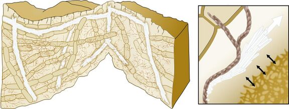 Model for biomineralization‐mediated scaffolding of bacterial biofilms A directed growth of the calcium carbonate crystals allows mechanical support of the 3D structure. The bacterial extracellular matrix (brown) promotes the crystals' growth in specific directions.[115][114]
