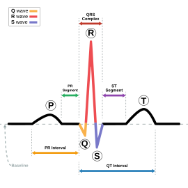 Normal sinus rhythm/EKG