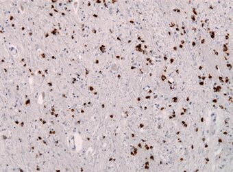 MSA aSynuclein.jpg