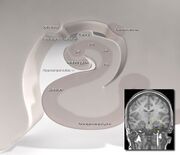 Hippocampus in relation to the lateral ventricle.