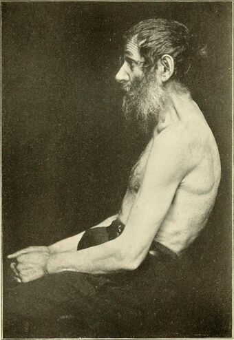 Geriatrics - the diseases of old age and their treatment, including physiological old age, home and institutional care, and medico-legal relations (1914) (14592233820).jpg