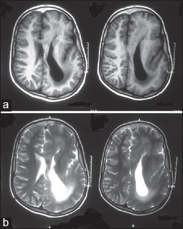 PMC4251029 AIAN-17-468-g002.png