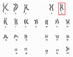Human male karyotpe high resolution - Chromosome 5.png