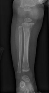 Wimberger corner sign