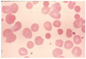 PMC2640351 1757-1626-2-97-1.png