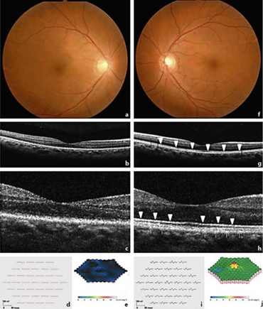 PMC3806683 cop-0004-0099-g01.png