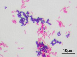 Gram stain 01.jpg