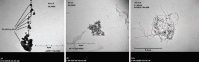 Three greyscale microscope images arranged horizontally. The left two show agglomerations of black spots on a grey background, while the right one shows a mass of tangled fibers.