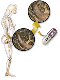 Medical illustration of hormone replacement therapy