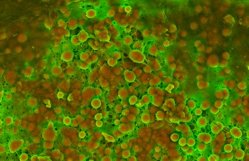 Density-Dependent Colour Scanning Electron Micrograph SEM (DDC-SEM) of cardiovascular calcification, showing in orange calcium phosphate spherical particles (denser material) and, in green, the extracellular matrix (less dense material)[71]