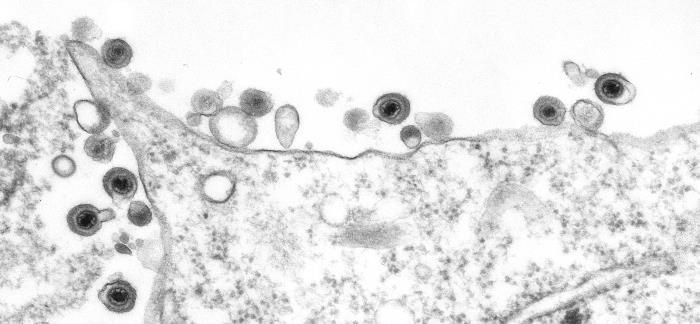 Electron microscopic image depicted numbers of human herpesvirus-8 (HHV-8) particle