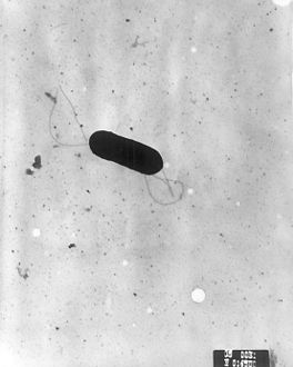 Electron micrograph of a flagellated Listeria monocytogenes, Magnified 41,250X.