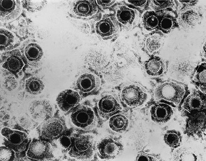 Transmission electron micrograph of Herpes simplex virus.
