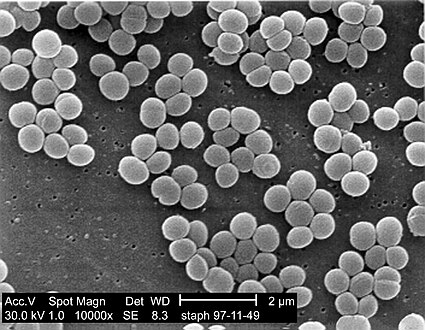 Scanning electron micrograph shows Staphylococcus aureus.