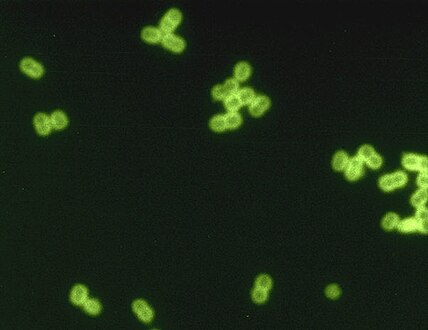 Streptococcus pneumoniae in cerebrospinal fluid