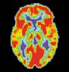 PET Normal brain