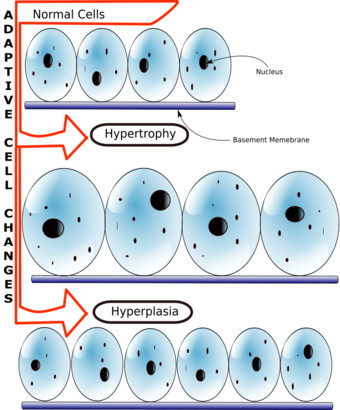 Hyperplasia vs Hypertrophy.svg