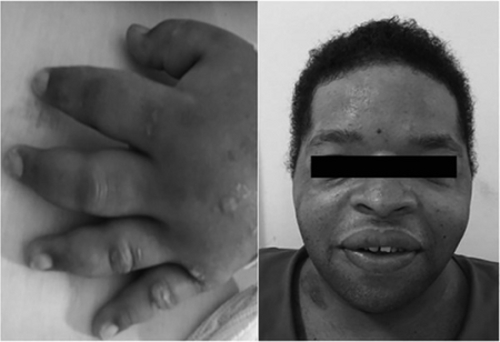 PMC5225924 rbti-28-04-0483-gf01.png