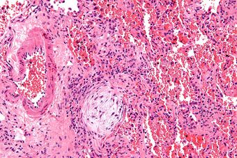 Masson body - high mag.jpg