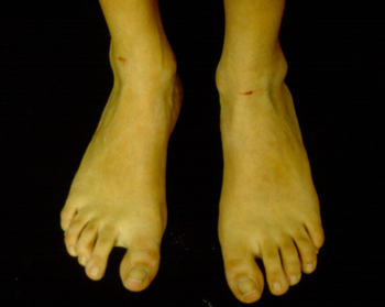 First toe is longer than the others and wide space between first and second toe.