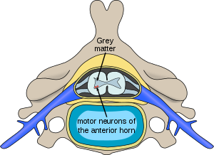 Polio spinal diagram-en.svg