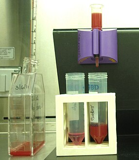 Magnetic collection of P.falciparum infected blood[15][16]