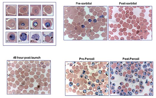 Blood stages of P.falciparum[10]