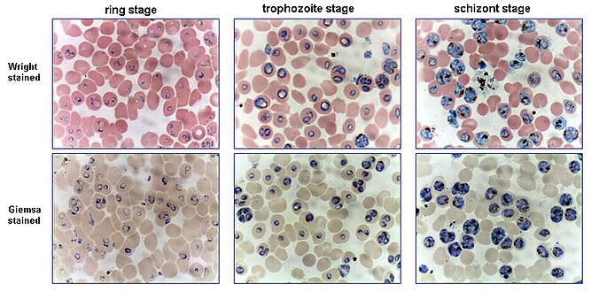 P. falciparum cultures[10]
