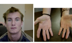 PMC2805625 1471-2350-10-144-3 (1).png