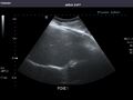 Liver