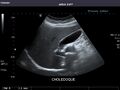 Bile duct