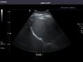 Liver