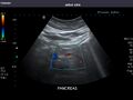 Pancreas