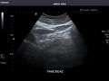 Pancreas