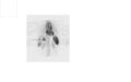 A nuclear medicine SPECT liver scan with technetium-99m labeled autologous red blood cells. A focus of high uptake (arrow) in the liver is consistent with a hemangioma.
