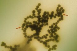 An electron micrograph of spherical nanoparticles clumped together