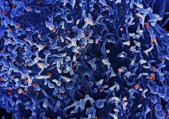 Scanning electron micrograph of mpox virus orange on the surface of infected VERO E6 cells