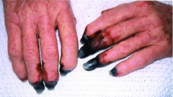 PMC3375793 07-0099-F1.png